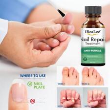 Nail Fungus Removal Cream Anti Fungal Foot Nails Repair Care Treatment B4W0