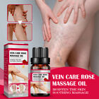 10ml Varicose Treatment Serum Veinhealing Veins Legs Pain Relief Care Oil Treat