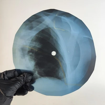 DOORS FIVE TO ONE X-Ray USSR Record Roentgen Bone Ribs Music Vinyl - Image 1 of 2