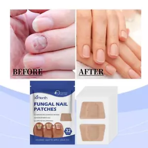Nagelpilz-Pflaster mit extra starker Wirkung 8-Stunden-Erneuerung über NEU V 🥇 - Bild 1 von 23