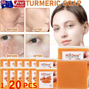 20xTurmeric Soap Anti Acne Skin Whitening Bleaching Face&Body Dark Spots Removal - Picture 1 of 28