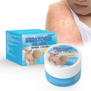 Salicylic Acid Urea Foot Cream Chicken Skin Removal Moisturizer Skin O8Y7 - Picture 1 of 12