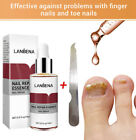 Nail Repair Essence Remove Onychomycosis Serum Fungal Nail Treatment For LANBENA