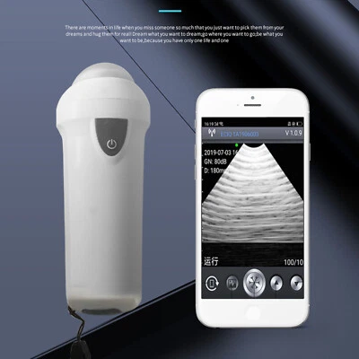 GOYOJO Wireless Veterinary Ultrasound Scanner Probe Pregnancy Farm For Sheep Pig WifiIM