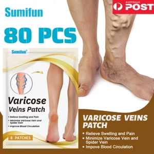 80Pcs Varicose Veins Patch Leg Pain Herb Plaster Varicose Vein Treatment Sticker - Picture 1 of 12
