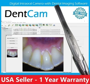 DentCam Dental Intraoral Intra-Oral HD LED Digital Imaging USB Camera Capture - Picture 1 of 10