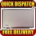17.3&quot; SCREEN FOR HP-COMPAQ OMEN 17-W005NS FULL HD MATTE WITH BRACKETS