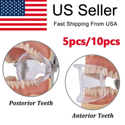 CAREPACY Dental Endodontic Mouth Opener Lip Cheek Retractor Expander Bite Prop Block-Gag