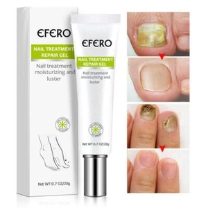 20g EFERO Nail Repair Essence Remove Onychomycosis Serum Fungal Nail Treatment - Picture 1 of 8