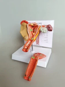 Pathologisches Modell des weiblichen Fortpflanzungssystems, urogenitalmedizinische Lehre - Bild 1 von 5