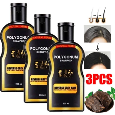 3x 200ml Reverse Grey Hair Darkening Shampoo Natural Polygonum Essence Hair Care