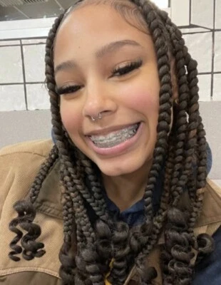 Soportes Brackets Estetic False sin reparación solo cosméticos Foto 1 de 4