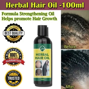 Hair Growth Spray Oil Anti Hair Loss Fast Grow Essence Care Products 100ml - Picture 1 of 15