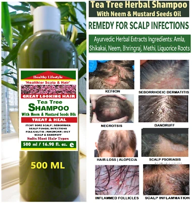 Folliculitis Shampoo Ringworm Scalp Dermatitis - Tea Tree Herbal Shampoo 500ML