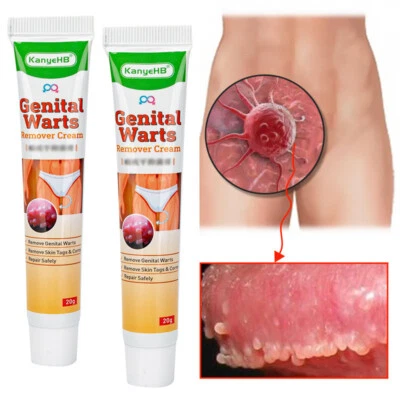 Wart Remover Genital Ointment for Removing Genital Warts - Image 1 of 4