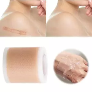 Scar Patch Silicone Scar Paste Effectively Remove Scars Reusable Washable` V8K9 - Picture 1 of 17