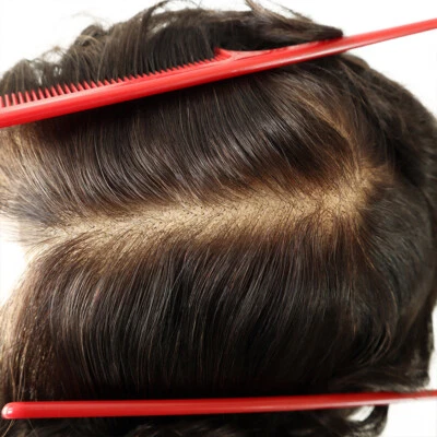 Toupee For Men Human Hair Swiss Lace Replecement System Natural Gent Hairpieces - Image 1 of 4