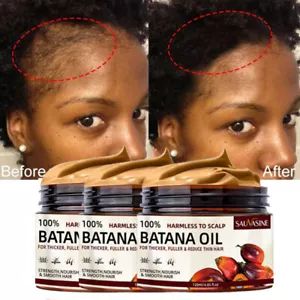 3X Natural Batana Oil Conditioner for Thicker, Fuller Hair Growth Anti-Hair Loss - Picture 1 of 16