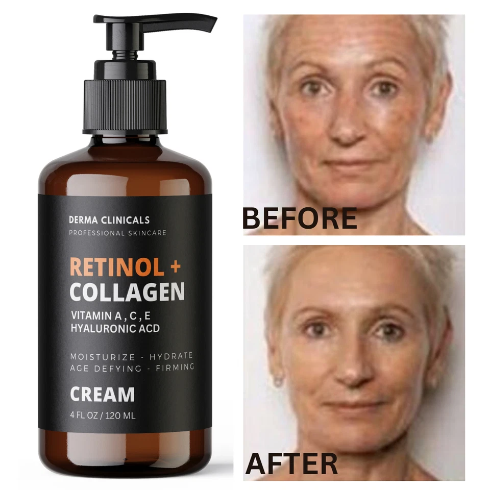 DERMA CLINICALS Retinol + Collagen, Hyaluronic Acid, Vitamin C AntiAging Wrinkle Serum Cream 4oz