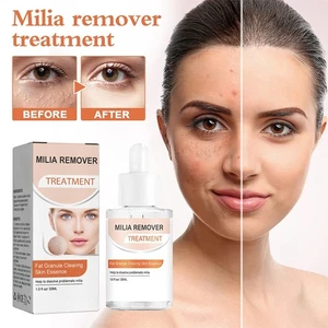 Milia Remover Treatment Milia Spot Removal Serum For Face Helps to Ruduce Milia - Picture 1 of 12