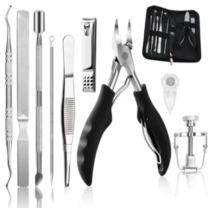 Professional 10-Piece Ingrown Toenail Correction Kit - Easy Home Treatment - Picture 1 of 7
