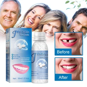 Teeth Glue For Loose Teeth Temporary Tooth Repair Beads Loose Tooth Repair fine - Picture 1 of 12