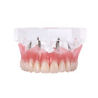 Dental Upper Maxillary Teeth Model Typodont Teeth Model Demo Clear 6001C