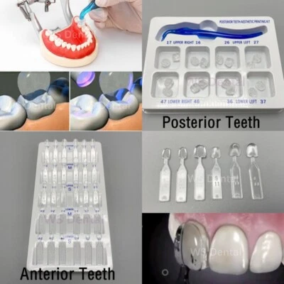 Stampo faccette dentali resina composita denti anteriori posteriori restauro molare - Immagine 1 di 4
