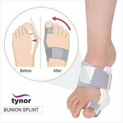 Tynor Bunion Splint Universal Size Helps Correct Congenital Deformities Big Toe - Image 1 of 4