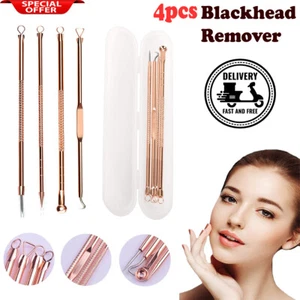 4X MITESSER & WEISSKOPF AKNE POPPER PICKEL PICKEL ENTFERNER KLEINES WERKZEUG - Bild 1 von 11