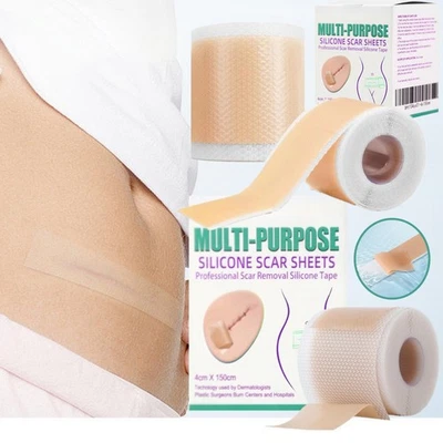 Silicone Scar Tape Collagen Scar Tape Scar Sheets Tape Roll For Delicate Skin - Image 1 of 4