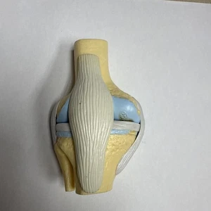 Functional Flexible Knee Joint Anatomical Model With Early Stage Osteoarthritis - Picture 1 of 5