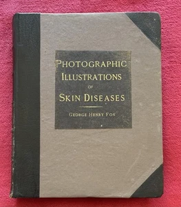 1886 PHOTOGRAPHIC ILLUSTRATIONS OF SKIN DISEASES by GEORGE HENRY FOX - Picture 1 of 23