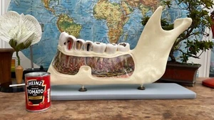 DIENTES de escuela de medicina modelo anatomía educativo mandíbula inferior somso de colección grande - Imagen 1 de 12