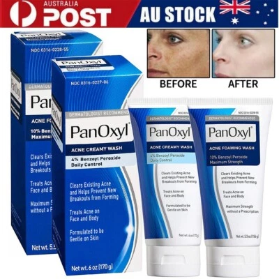 Acne Foaming Wash for Face & Body 4% 10% Benzoyl Peroxide Acne Foaming Cleanser - image 1 of 4