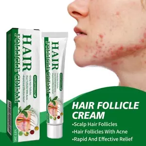 Hair Follicle Cream Folliculitis Cream Skin Care Natural Ingredients, 20g D4T6/ - Bild 1 von 13
