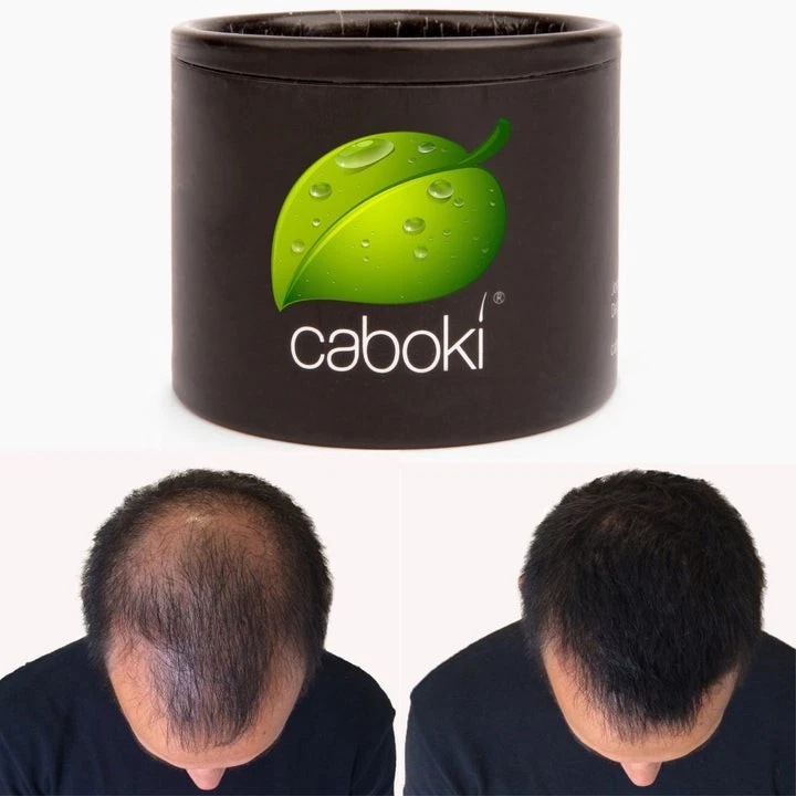 Hair Fiber Stim Hair Loss - Image 1 of 1