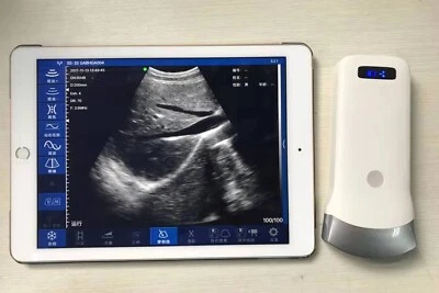 Sonda convexa de ultrassom sem fio 3,5-5mhz 80 elementos scanner máquina portátil - Imagem 1 de 4