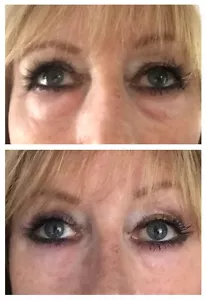 No.1 Instant Wrinkle Serum- NEW FORMULA FOR DARKER SKIN TONES- NO WHITE RESIDUE! - Picture 1 of 3