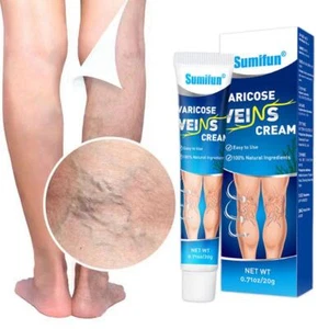 NEW Varicose Vein Cream Herbal Varicose Veins Treatment Cream for Legs Spider - Picture 1 of 11