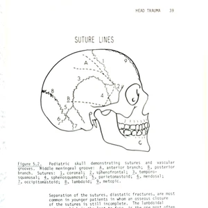 Vintage Neurosurgical Management for The House Officer Book Softcover 1984 - Picture 1 of 14
