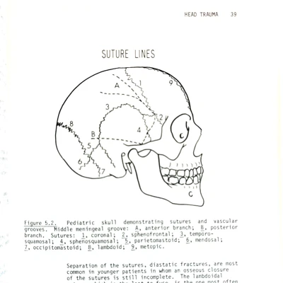 Vintage Neurosurgical Management for The House Officer Book Softcover 1984 - Image 1 of 4