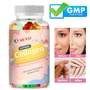 MENXI 60 Biotin & Collagen Hair Growth Gummies - Hair,Skin,Joints Vitamin Health - Picture 1 of 10