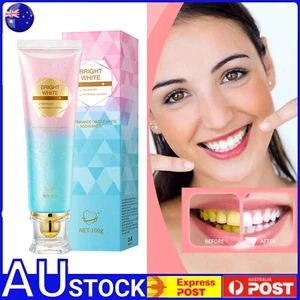 Niacinamide Whitening Toothpaste,Teeth Whitening DX - Picture 1 of 14
