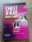 Chest X Ray Made Easy By Jonathan Corne Kate Pointon Paperback 2009
