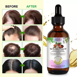 Anti Hair Loss Damaged Dry Scalp Repair Natural Regrowth Hair Growth Power Oil - Picture 1 of 12