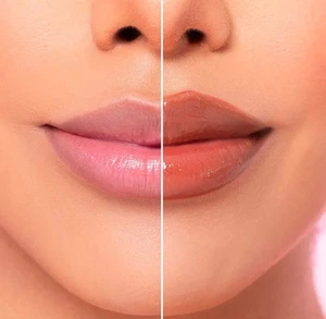 Brandneu Beauty Creations Plump And Pout Trending Injektion  - Bild 1 von 3