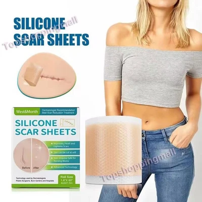1.5M-5M Scar Silicone Sheet Gel Patch Removal Skin-Treatment Repair Wound Burn - Image 1 of 4