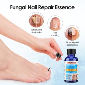Ginger Antibacterial Fungal Nail Growth Healing Treatment Repair Serum 42.5 - Picture 1 of 16