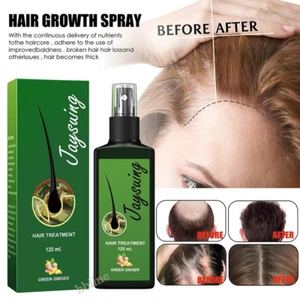 Ginger Hair Growth Spray, Hair Growth Oil and Serum, Prevents Hair Loss 120 ml. - Picture 1 of 8